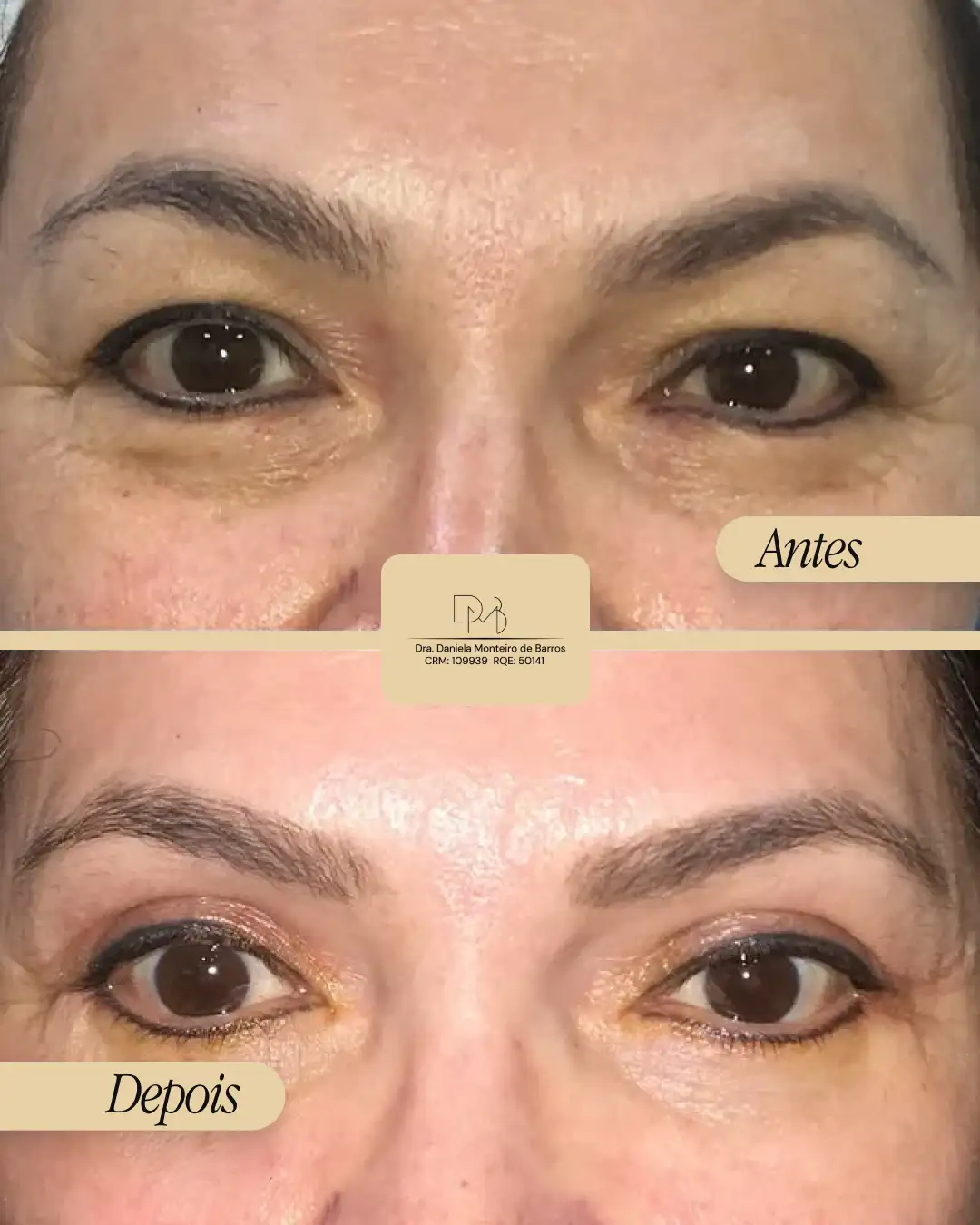 antes_e_depois_
