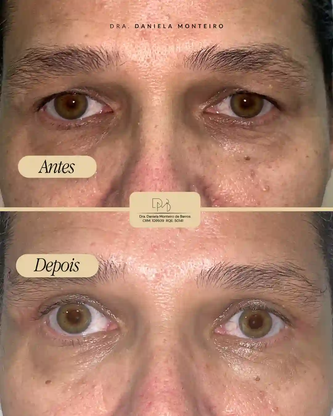 antes_e_depois_3