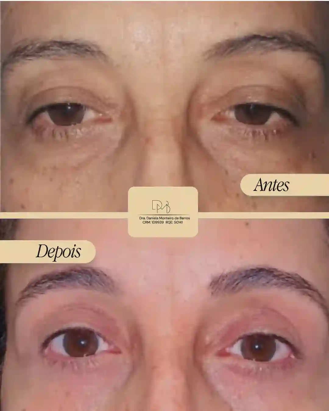 antes_e_depois_5