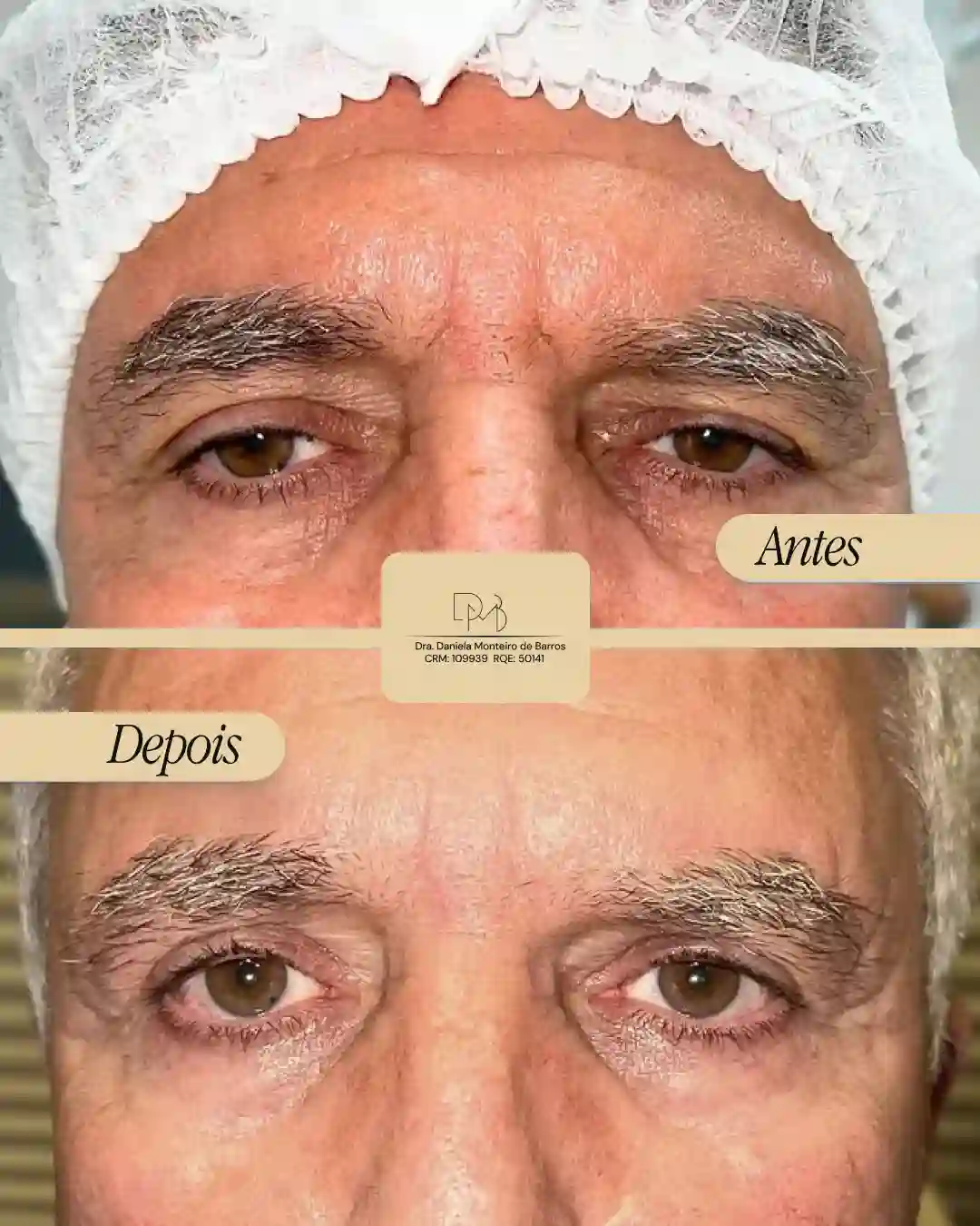 antes_e_depois_6