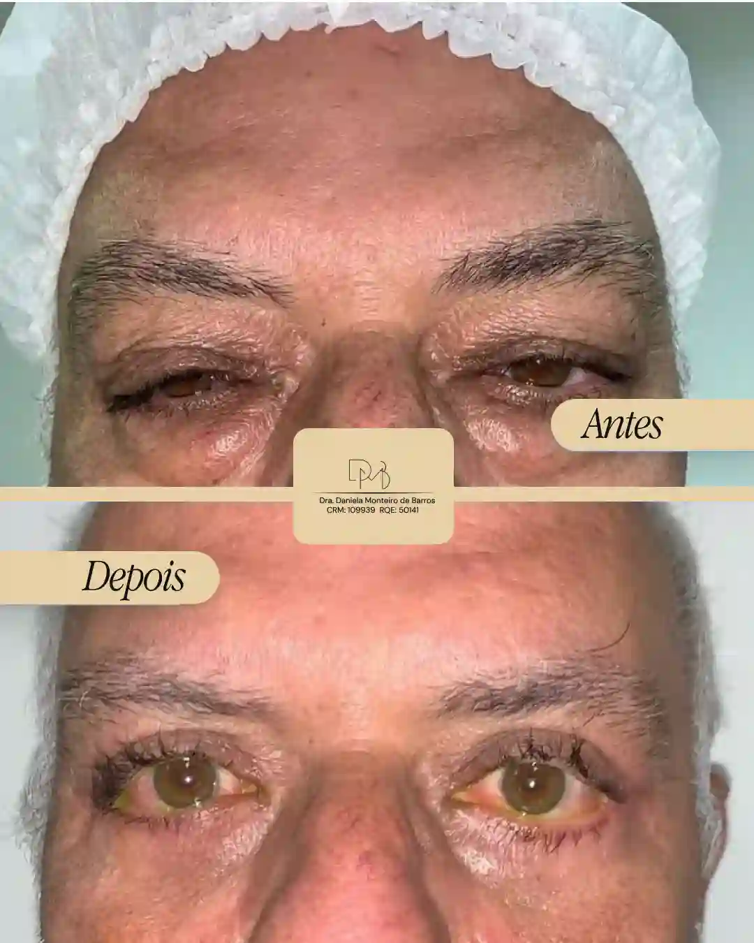 antes_e_depois_7