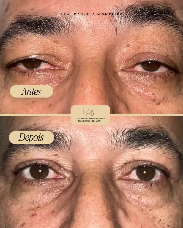 antes_depois_2