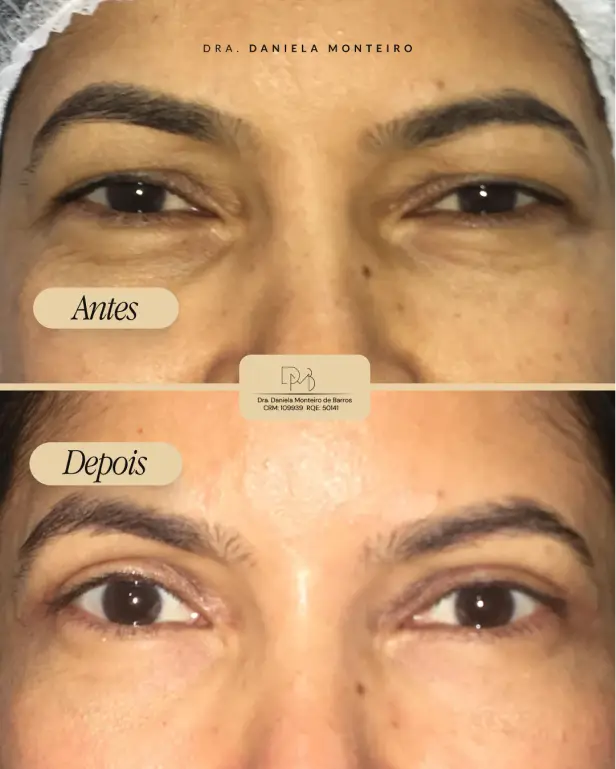 antes_depois_3