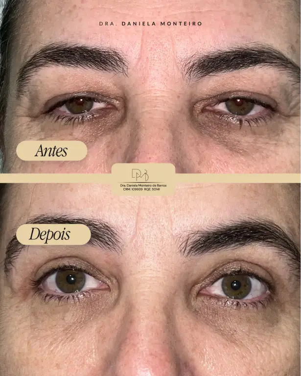 antes_depois_4