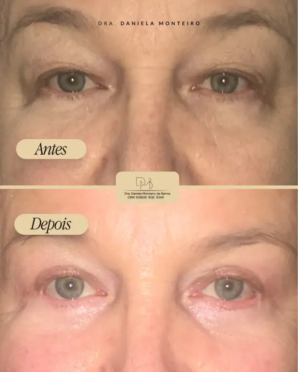 antes_depois_5